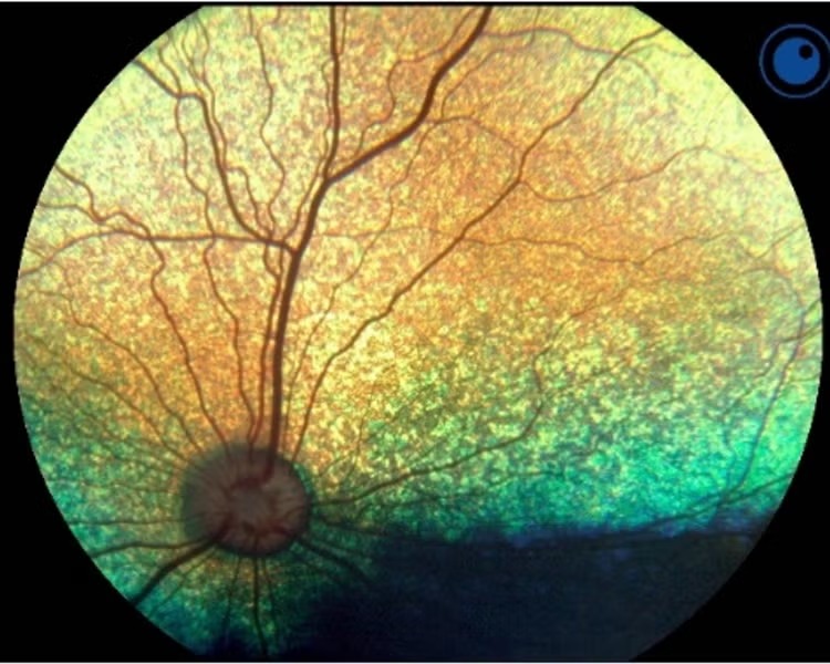 Egészséges kutya szemfeneke