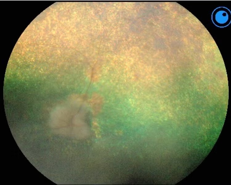 PRA-val érintett kutya szemfeneke